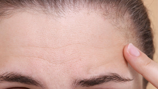 5 consejos para prevenir y eliminar las arrugas del entrecejo