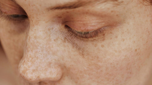 Retinol o retinal: qué son, diferencias y qué piel debe usar cada uno