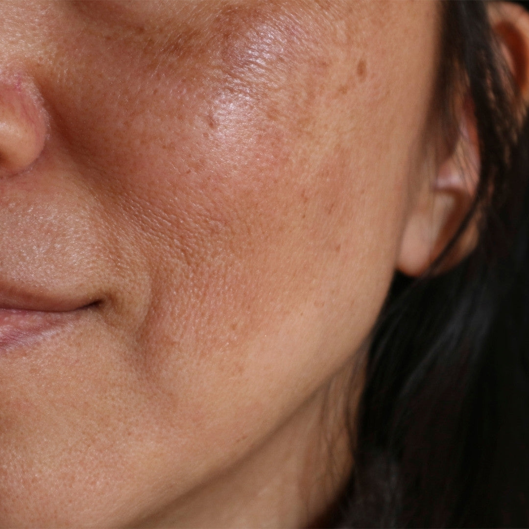 ¿Cómo quitar las manchas de la cara con cosmética? 3 pasos