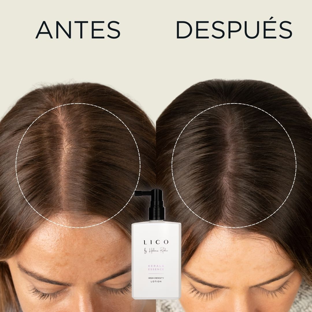 Antes y después Capilar