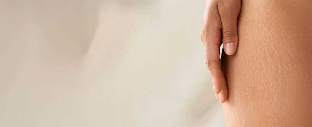 Banner Anticelulítico